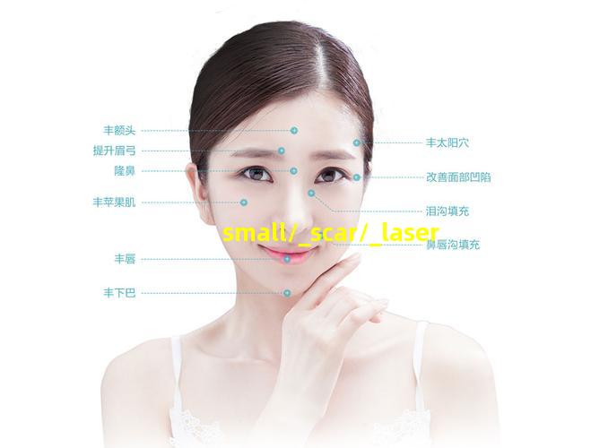 小疤痕激光治疗